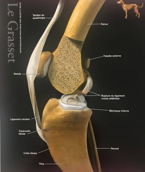 Ligaments croisés (genou)